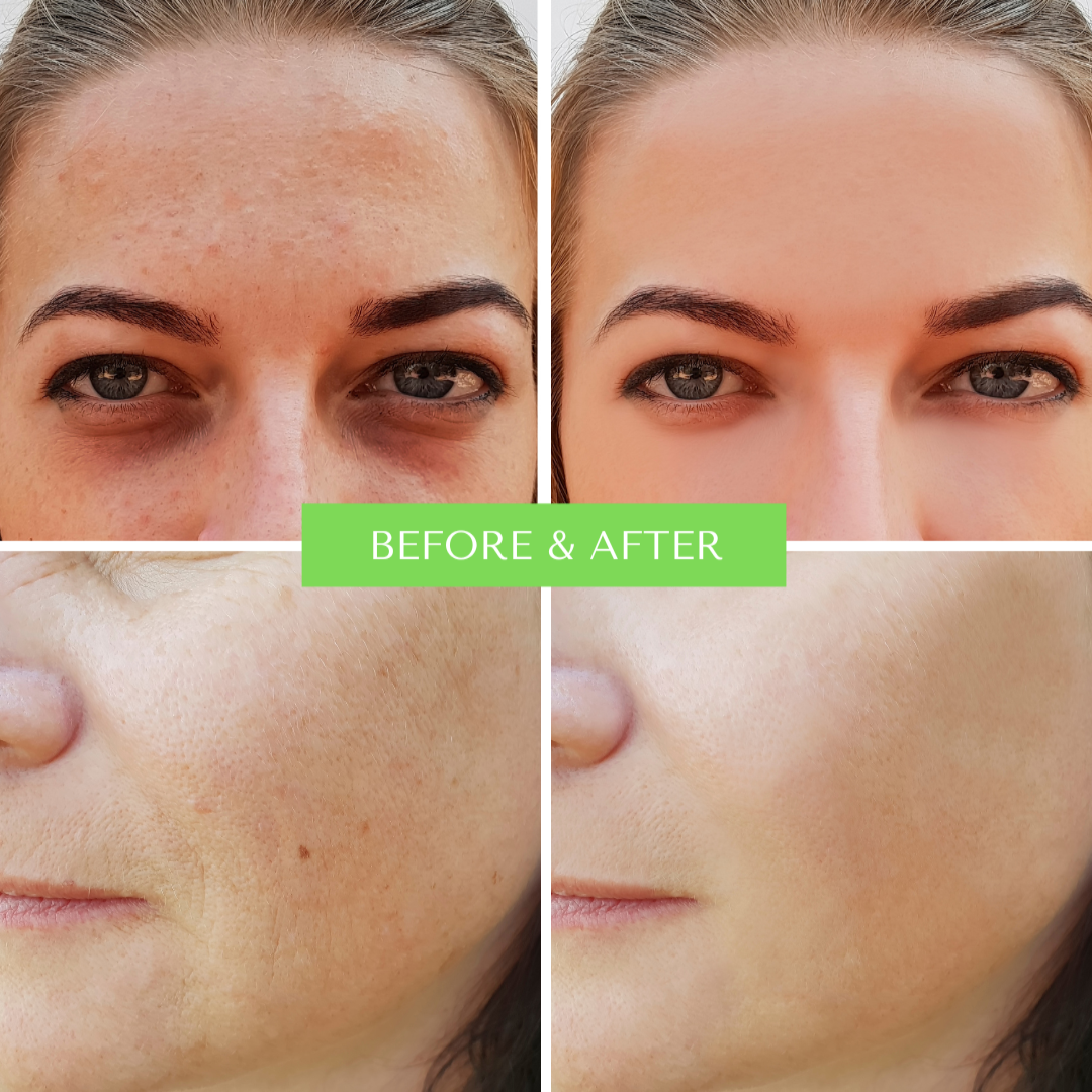 ORGANIC HYALURONIC WRINKLE DEFIER - For Women and Men